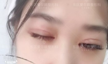 【第189期】95后护士小姐姐：一双眼睛改变一个人